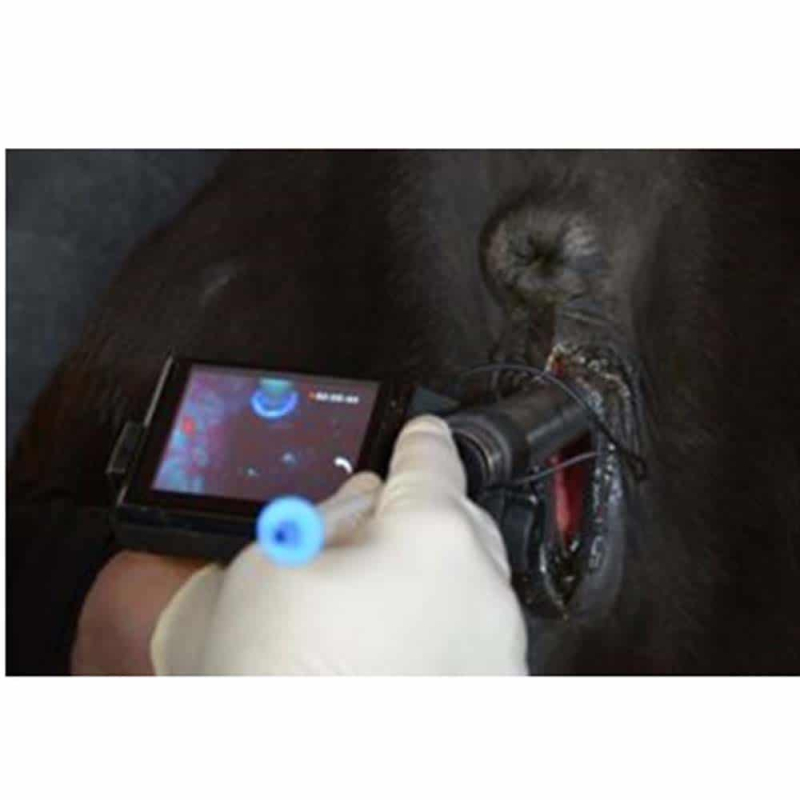 Superscope
