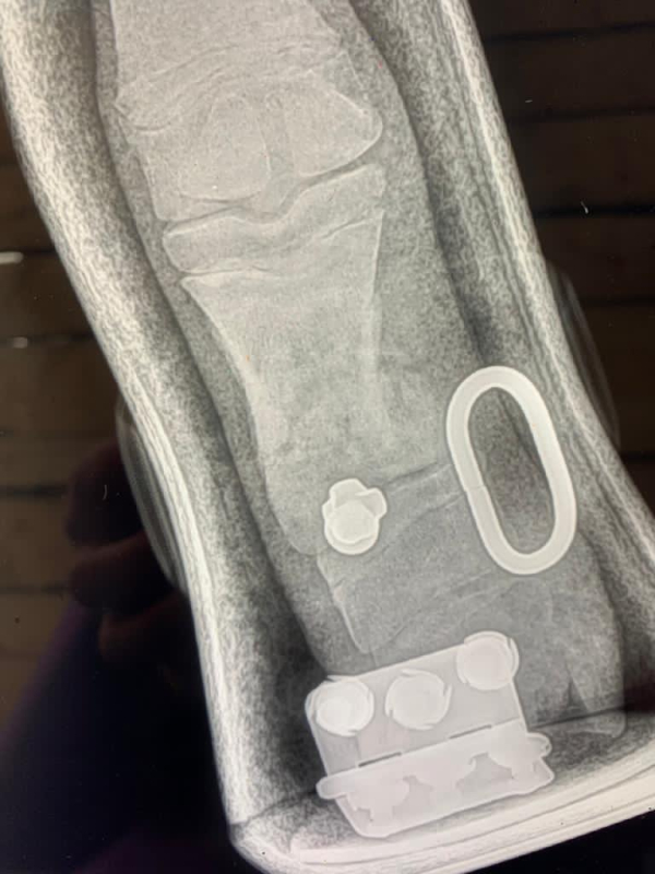 Redboot Korrekturschiene für Fohlen